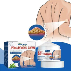 Herbal Lipoma Removal Cream – Natural Fat Peeling Solution
